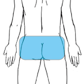臀部の部位画像